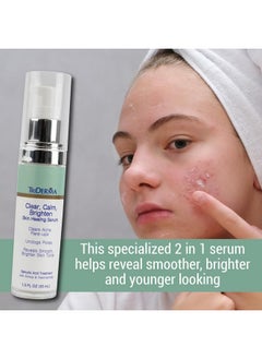TriDerma Clear Calm Brighten Skin Serum With 2% Salicylic Acid And Niacinamide Reveals Smoother Brighter More Even Skin Clears Acne Blemishes Blackheads And Unclogs Pores 1 Oz  - Image 5