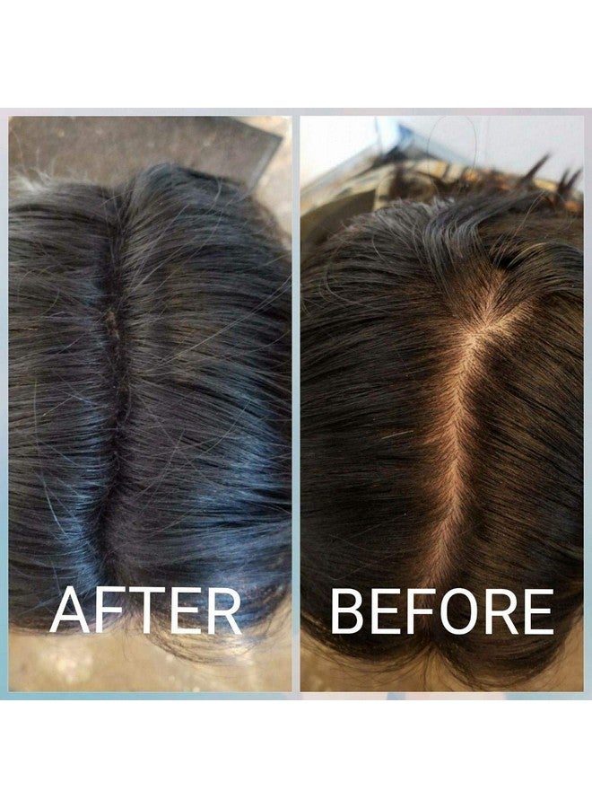 SKINPLUS Hair Building Fibers, Keratin-Derived Fibres For Naturally Thicker Looking Hair, Thick Fiber (Black) - Image 3