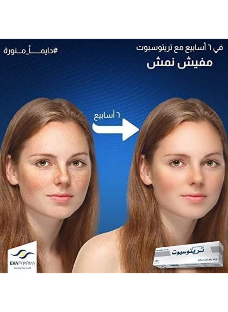 Tritospot Whitening Cream for Hyperpigmentation Problems, Melasma, Scars Freckles, Pimple Marks and Dark Spots - 3 Pieces