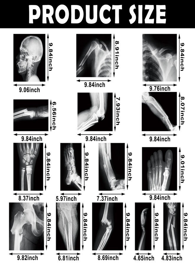 Sayglossy 15 Pcs Broken Bones x Ray Set Human x Rays Black and White Skeleton Pretend Xrays for Kids - Image 2