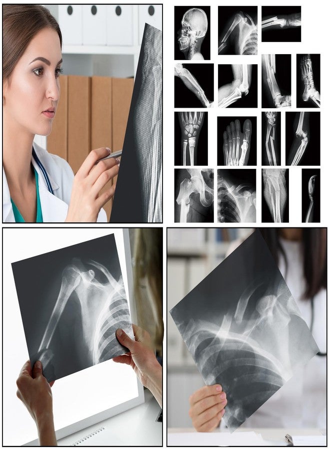 Sayglossy 15 Pcs Broken Bones x Ray Set Human x Rays Black and White Skeleton Pretend Xrays for Kids - Image 4
