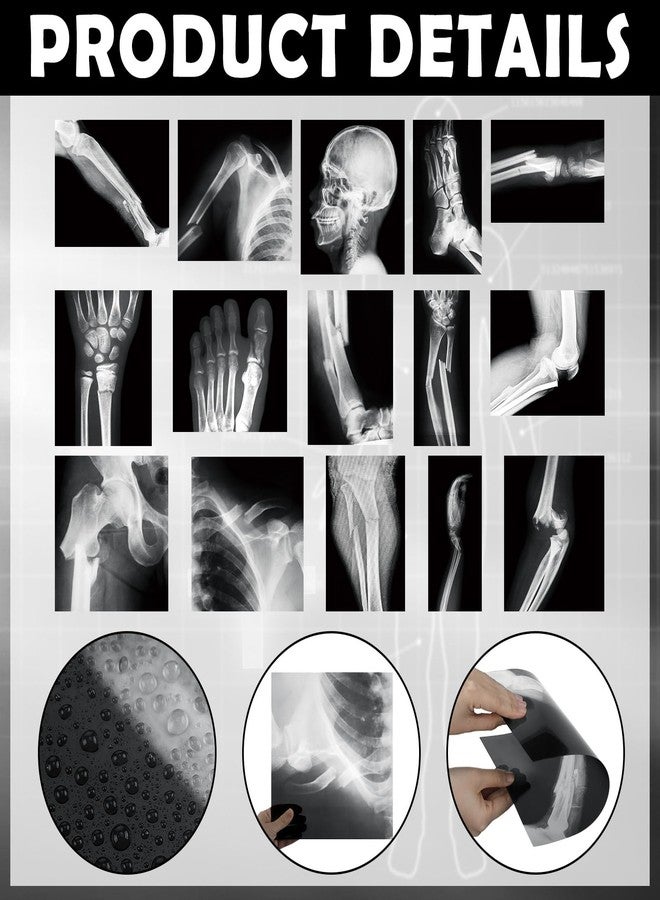 Sayglossy 15 Pcs Broken Bones x Ray Set Human x Rays Black and White Skeleton Pretend Xrays for Kids - Image 3