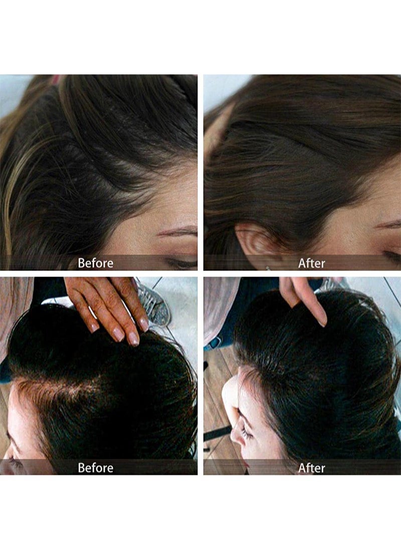 Sevich - Hair Root Concealer，Hair Mascara Hairline Powder 8g Instantly Hair Root Touch Up for Thinning Hairline Cover Up Conceals Hair Loss Thin Hair Receding Hairline Shadow Filler For Men & Women (Black) - Image 1
