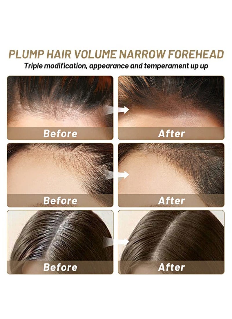 Sevich - Hair Root Concealer，Hair Mascara Hairline Powder 8g Instantly Hair Root Touch Up for Thinning Hairline Cover Up Conceals Hair Loss Thin Hair Receding Hairline Shadow Filler For Men & Women (Black) - Image 1