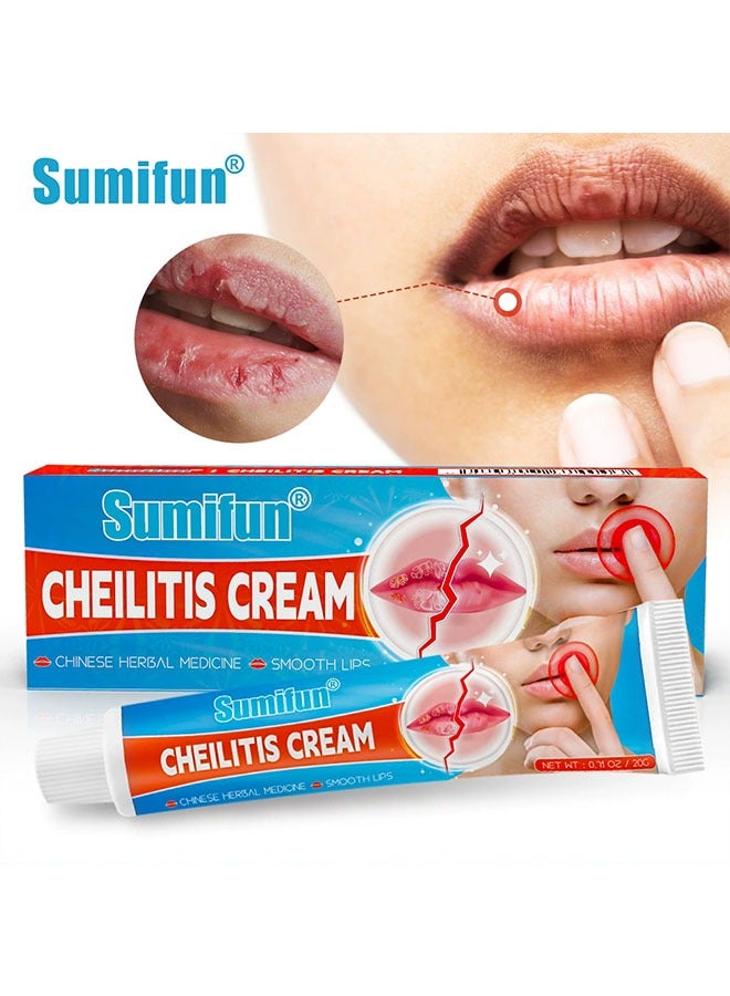 سوميفون Cheilitis Cream ، مرطب شفاهي للشفاه شديدة التشقق ، مكونات طبيعية للتبريد الفوري وتخفيف الآلام ، إزالة الجلد الميت / تلاشي خطوط الشفاه / تحسين لون الشفاه 20 جم - Image 1