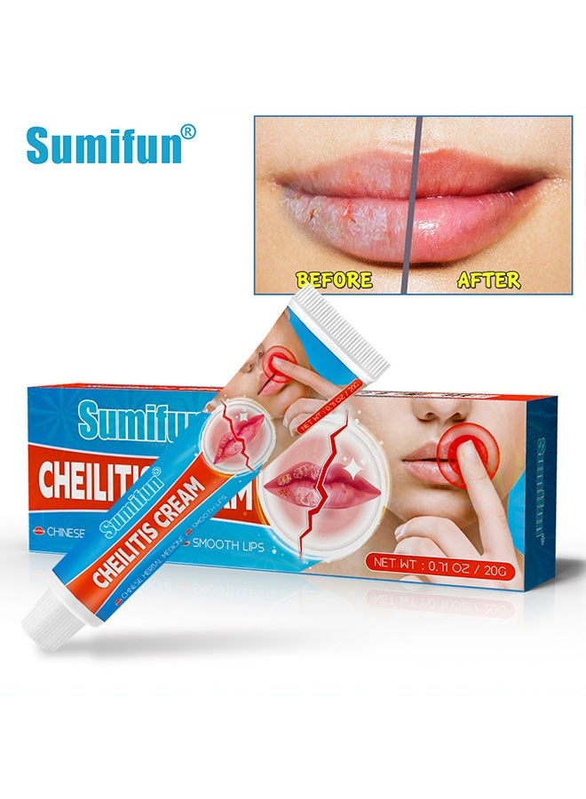 سوميفون Cheilitis Cream ، مرطب شفاهي للشفاه شديدة التشقق ، مكونات طبيعية للتبريد الفوري وتخفيف الآلام ، إزالة الجلد الميت / تلاشي خطوط الشفاه / تحسين لون الشفاه 20 جم - Image 2