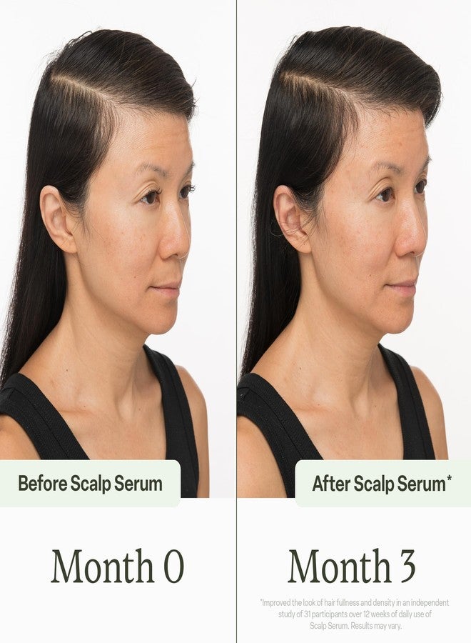 ديفي مجموعة ديفي للعناية بالشعر الصحي - تتضمن سيروم لفروة الرأس (30 مل) وفيتامينات للشعر (60 حبة) - تستهدف تساقط الشعر، وتدعم نموه، وتغذي بصيلاته للحصول على شعر أكثر كثافة وامتلاءً ومظهرًا صحيًا، طقم من قطعتين - Image 4