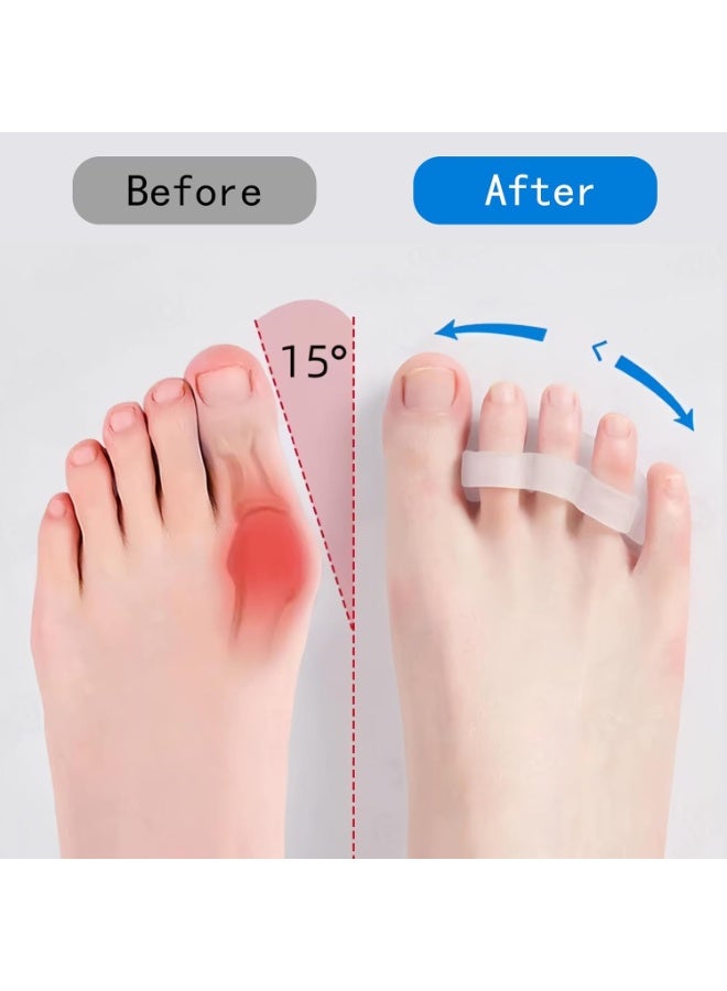 فواصل أصابع القدم للعناية بالقدم – فاصل أصابع جل ناعم – مصحح ومحاذي أصابع القدم للرجال والنساء – لتقويم الأصابع المتداخلة وعلاج الوكعة وأصابع المطرقة - Image 2