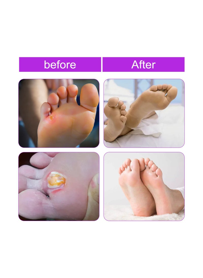 Wart Removal Fast Healing Set With 3 Products