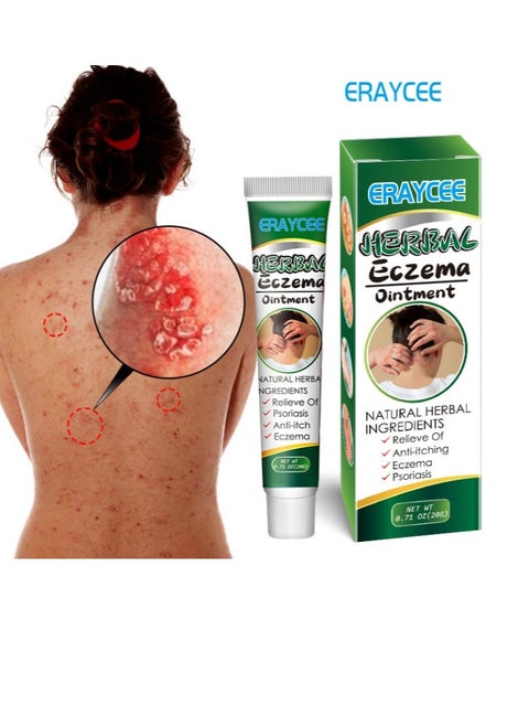 Natural Body Psoriasis Eczema Cream Ointment  Eczema Relief Body Cream, Anti Itch Back Cream Skin Care To Relieve  Suitable For All Body 20g