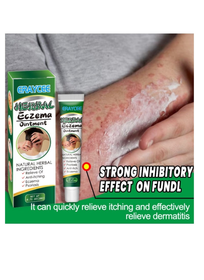Natural Body Psoriasis Eczema Cream Ointment  Eczema Relief Body Cream, Anti Itch Back Cream Skin Care To Relieve  Suitable For All Body 20g