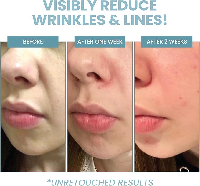 Eva Naturals Retinol Serum 25 by Eva Naturals 60 ml DoubleSized Bottle Best AntiAging Serum Minimizes Wrinkles Helps Prevent Sun Damage and Fades Dark Spots Vitamin A Retinol with Hyaluronic Acid - Image 4