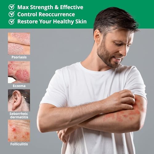 Hermon Psoriasis Eczema Relief Cream: Maximum Strength for Psoriasis Eczema - Relieve Symptom of Resistant Effective for Seborrheic Dermatitis Folliculitis 100m 3.4 Fl Oz (Pack of 1) - Image 2
