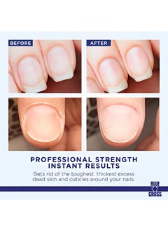 Blue Cross Professional Nail Care，Hydrating, Moisturizing, Strengthening Liquid Cuticle Remover ，Softener with Lanolin for Brittle Nails, Hang Nails， Dry Cuticles（177ml）  - Image 3