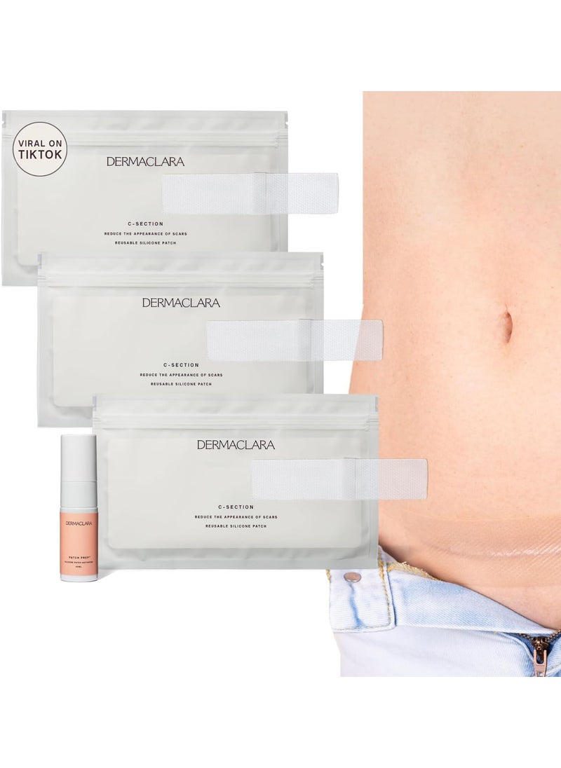 Dermaclara Dermaclara C-Section Scar Patch - Pregnancy Stretch Mark Prevention & Removal, C Section Cover Up Belly Scar, Maternity Skincare, Silicone Gel Sheet, Reusable up to 30 Times- 4 Patches, Patch Cleanser 