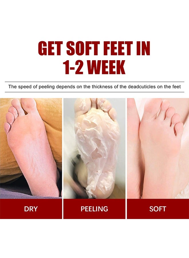 Exfoliating Foot Mask, AHA 30%+BHA 2% Peeling Solution, Moisturizing, Removes Calluses, Hydrates, Heals Cracked Dry Rough Heels, Peels Off Dead Skin 5 Pairs
