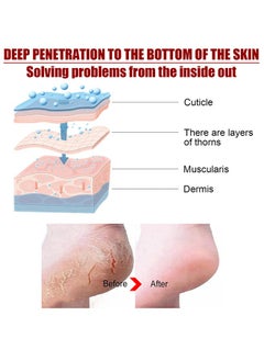 Jaysuing Exfoliating Foot Mask, AHA 30%+BHA 2% Peeling Solution, Moisturizing, Removes Calluses, Hydrates, Heals Cracked Dry Rough Heels, Peels Off Dead Skin 5 Pairs  - Image 3