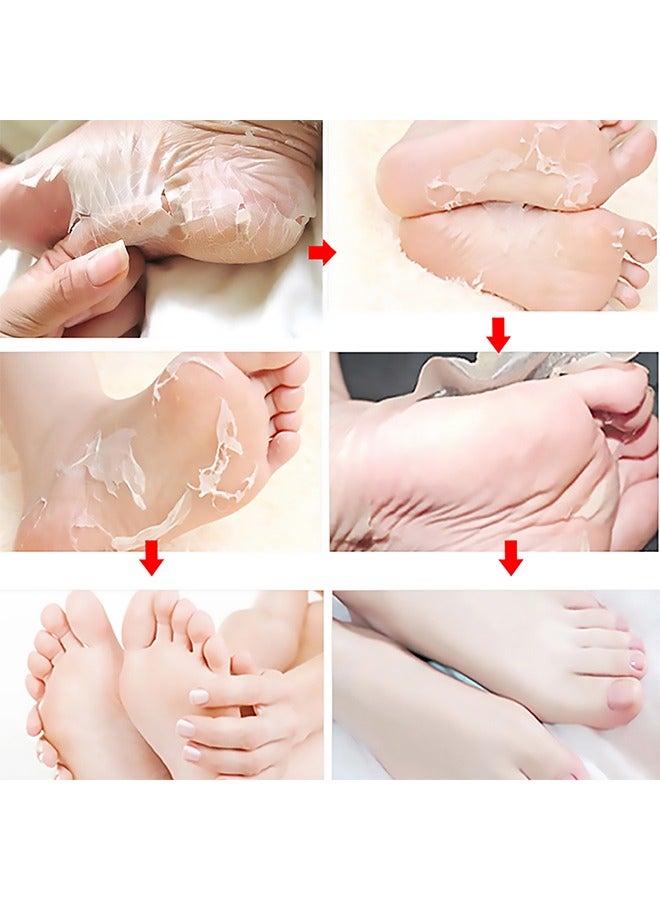 Exfoliating Foot Mask, AHA 30%+BHA 2% Peeling Solution, Moisturizing, Removes Calluses, Hydrates, Heals Cracked Dry Rough Heels, Peels Off Dead Skin 5 Pairs