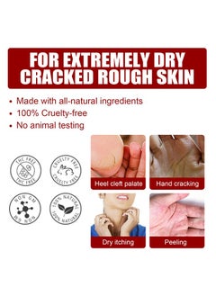 Jaysuing Exfoliating Foot Mask, AHA 30%+BHA 2% Peeling Solution, Moisturizing, Removes Calluses, Hydrates, Heals Cracked Dry Rough Heels, Peels Off Dead Skin 5 Pairs  - Image 4