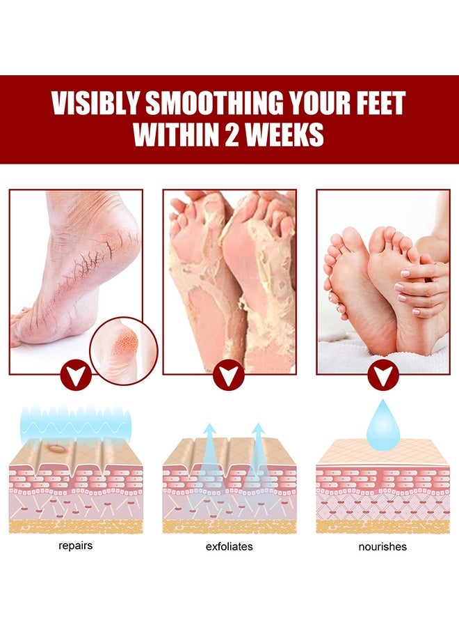 Exfoliating Foot Mask, AHA 30%+BHA 2% Peeling Solution, Moisturizing, Removes Calluses, Hydrates, Heals Cracked Dry Rough Heels, Peels Off Dead Skin 5 Pairs