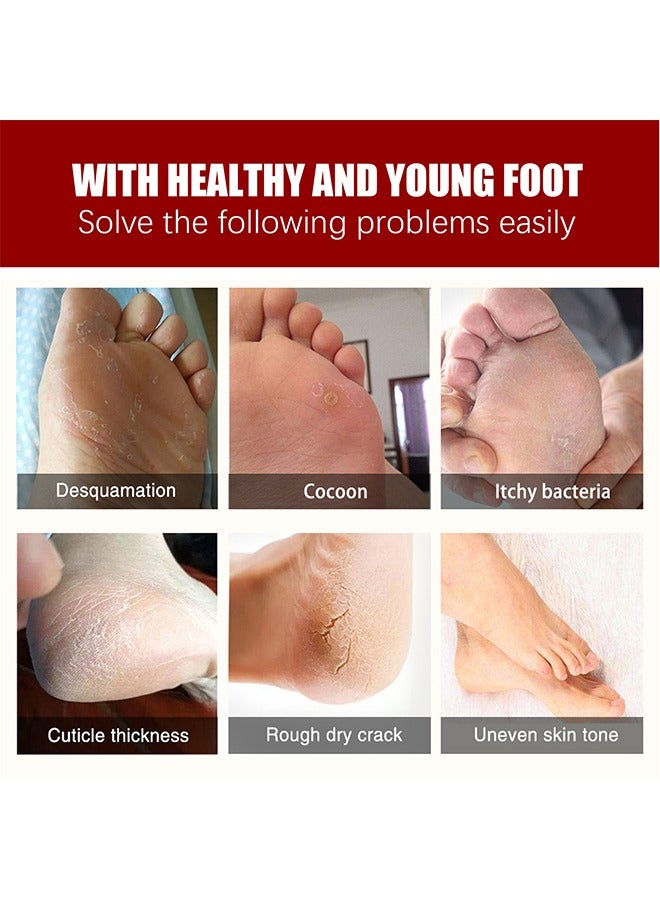 Exfoliating Foot Mask, AHA 30%+BHA 2% Peeling Solution, Moisturizing, Removes Calluses, Hydrates, Heals Cracked Dry Rough Heels, Peels Off Dead Skin 5 Pairs