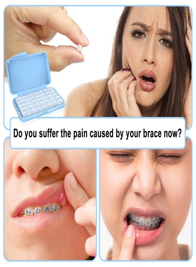 BVN Braces Wax 10 Pack (50 Strips Total – Orthodontic Wax for Braces, Dental Wax for Sharp Brackets, Mouth Ulcer Relief Wax for Braces Wearers, Aligners & Dentures - Image 4