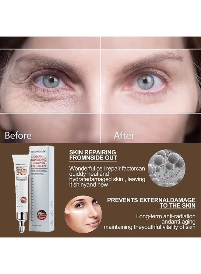فايبرنت جلامور Cayman Repair and Treatment Eye Cream 20g, كريم العيون السحري, كريم العيون لإزالة أكياس العيون, التجاعيد, الخطوط الدقيقة, كريم العيون المضادة للشيخوخة, كريم العيون المضادة للشيخوخة, كريم العيون المضادة للشيخوخة, كريم العيون المضادة للشيخوخة - Image 4