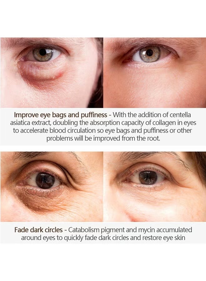 فايبرنت جلامور Cayman Repair and Treatment Eye Cream 20g, كريم العيون السحري, كريم العيون لإزالة أكياس العيون, التجاعيد, الخطوط الدقيقة, كريم العيون المضادة للشيخوخة, كريم العيون المضادة للشيخوخة, كريم العيون المضادة للشيخوخة, كريم العيون المضادة للشيخوخة - Image 5
