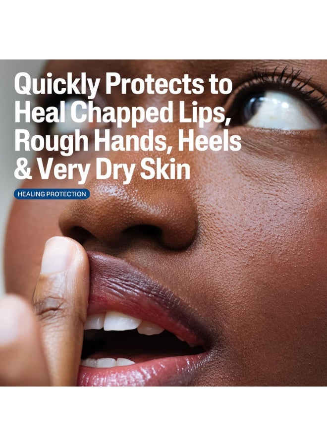 Cetaphil مرهم سيتافيل الشافي، 12 أونصة، للبشرة الجافة والمتشققة والمتهيجة، يعالج ويحمي، يهدئ اليدين المتشققتين والشفتين المتشققتين، مضاد للحساسية، خالي من العطور 12 أونصة (عبوة من 1) - Image 4