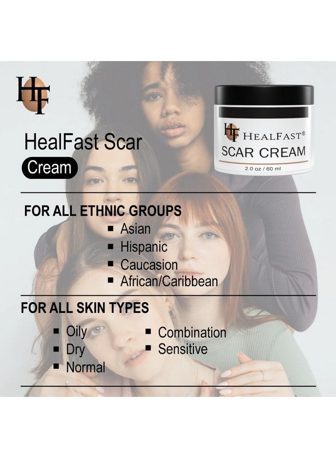 هيل فاست كريم HealFast الأصلي لعلاج علامات التمدد - يهدئ البشرة ويغذيها وينعشها - باستخدام تقنية Ovasome مع حمض الألانتوين وحمض ألفا ليبويك - 60 مل/2 أونصة - Image 3