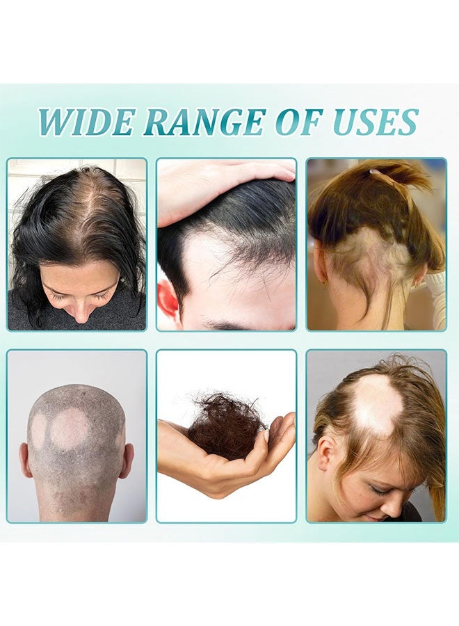 BARUBT 5% Scalp Massage Cream，Hair Growth Scalp Massage Cream, Anti Hair Loss Treatment for Men & Women, Fast Regrowth & Strengthens Hair Roots, Activates Follicles 100g - Image 2