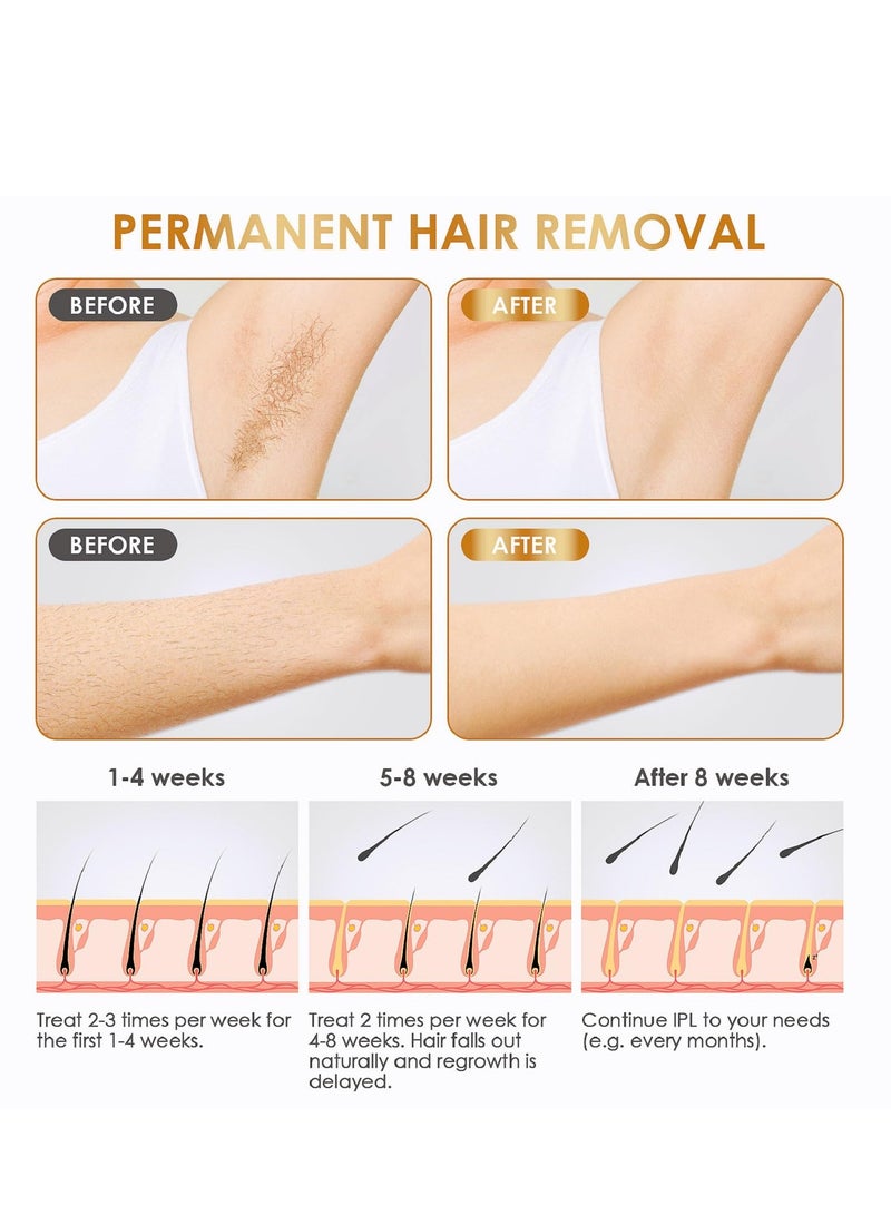 Excefore Laser Hair Removal for Women and Men, at-Home IPL Hair Removal, Permanent Painless Best Hair Remover Device for Face Bikini Line Armpit Leg Back, Corded - Image 5