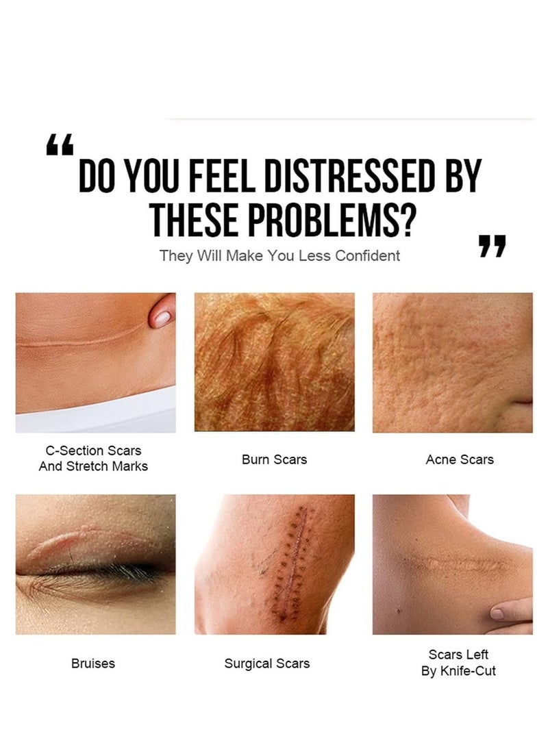 كريم الندبات كريم إزالة الندبات مناسب لتسريع شفاء الجروح والحروق والندبات غني بالمغذيات لإصلاح ألياف الكولاجين المرنة التالفة وإزالة الندبات - Image 2
