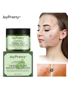 JoyPretty Herbal Acne Removing Cream- Acne Spot Treatment For Face And Acne Dots, Natural Cystic Acne Treatment, For All Skin Types, Premium Acne Scar Cream And Pimple Remover 50G  - Image 1
