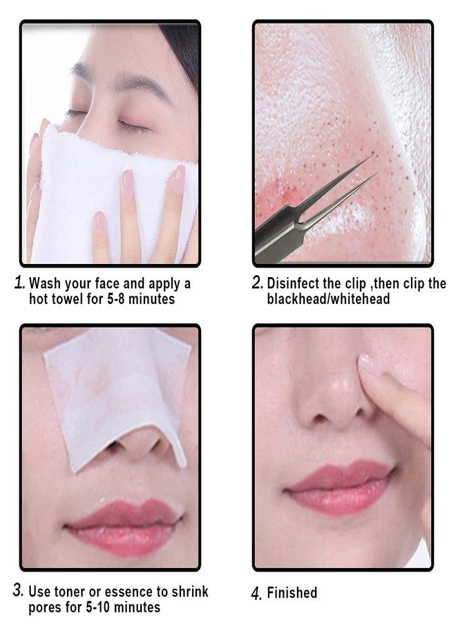 MUZE Professional Facial Milia Removal and Whitehead Pointed Tweezers - Precision Sharp Needle Nose Tool for Blackhead ,Pimple Popper & Fat Particles Remover - Zit and Pimple Acne Removal - Image 2