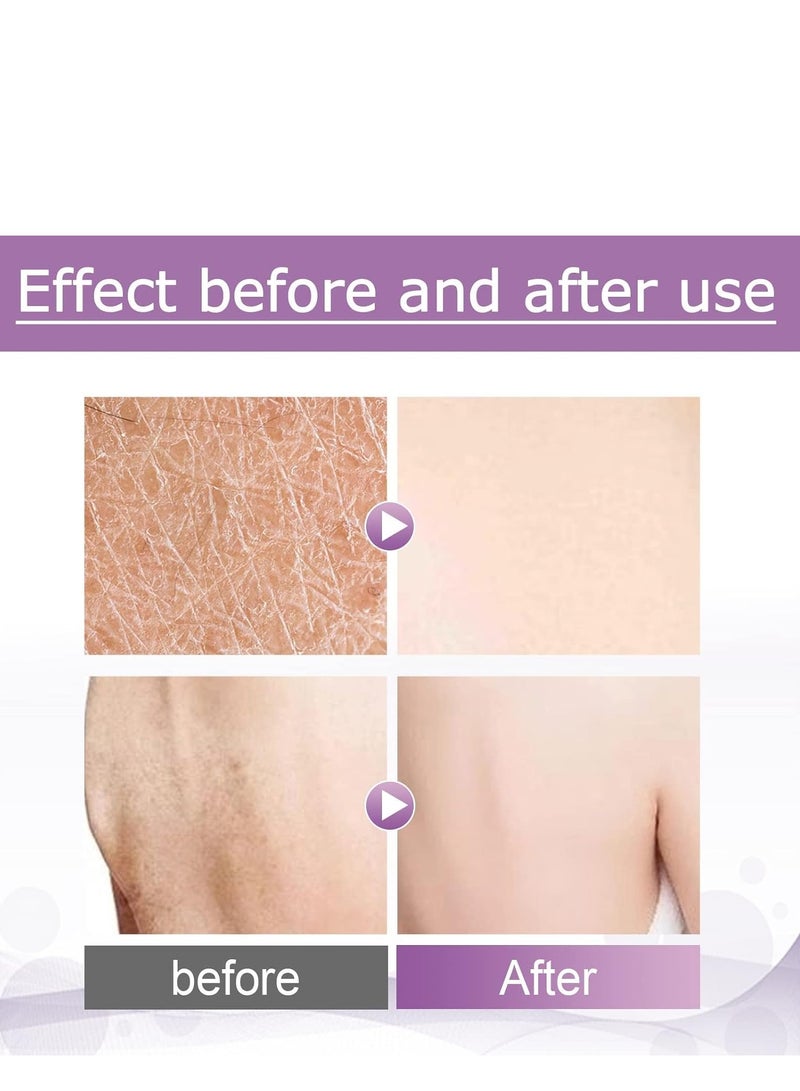 EELHOE Body Scrub Exfoliant, Body Bump Eraser, Natural Exfoliating, Ultra Hydrating, Body Souffle, Helps with Moisturizing Skin, Acne, Cellulite, Dead Skin Scars, Wrinkles 56.7g - Image 4