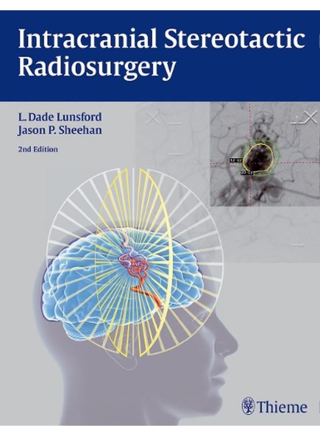 Intracranial Stereotactic Radiosurgery Ed 2