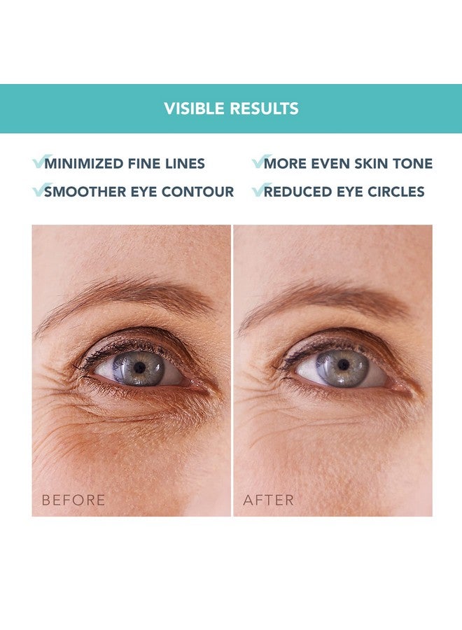 فوريو قناع فوريو آيريس هيدروجيل مرطب للعين - علاج الهالات السوداء تحت العين للنساء والرجال - علاج انتفاخ العين - مرطب ومنعش - نباتي - لجميع أنواع البشرة - 60 رقعة تحت العين - Image 4