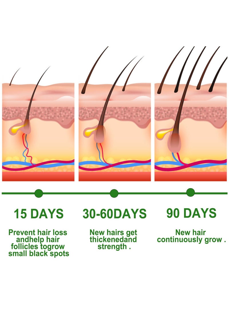 EELHOE 3-PACK Rosemary Hair Oil, Prevents Hair Loss, Nourishes Scalp And Repairs Damaged Hair 30ml*3 - Image 4