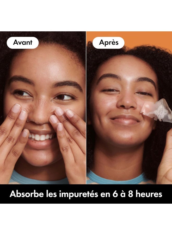 هيرو Hero - Mighty Patch Nose - Special nose - Absorbs impurities from pores and pimples in 6 to 8 hours - Hydrocolloids - Box of 10 Mighty Patches Nose - Image 5