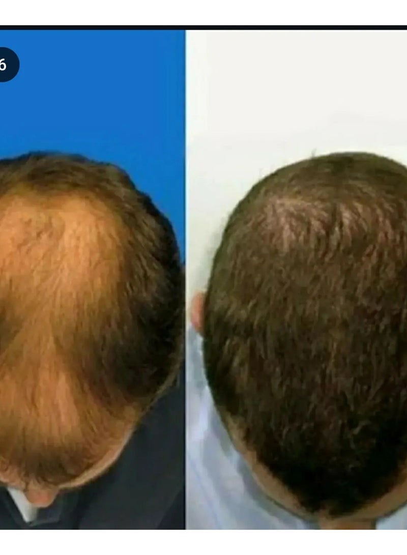 بروكسي سوفت بروكسي زيت شعر افغاني 125مل - Image 2