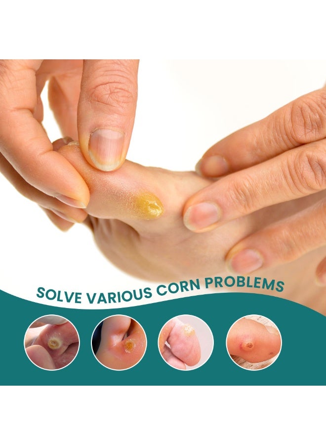 Sumifun 42 Pack Corn Removal Plaster Gentle Painless Foot Care Mat Effective For Corns Calluses Dead Skin With Foot Ding Plantar Wart Cream For Home Daily Use - Image 4