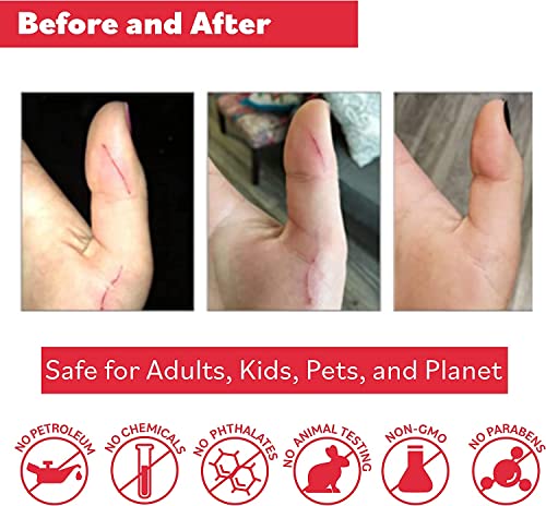 Puremedy Original Healing Ointment - All Natural First Aid Salve for Wounds, Burns, Cuts, Bug Bites, Bed Sores, and Skin Irritations - Safe for Adults & Kids (2 oz) - Image 4