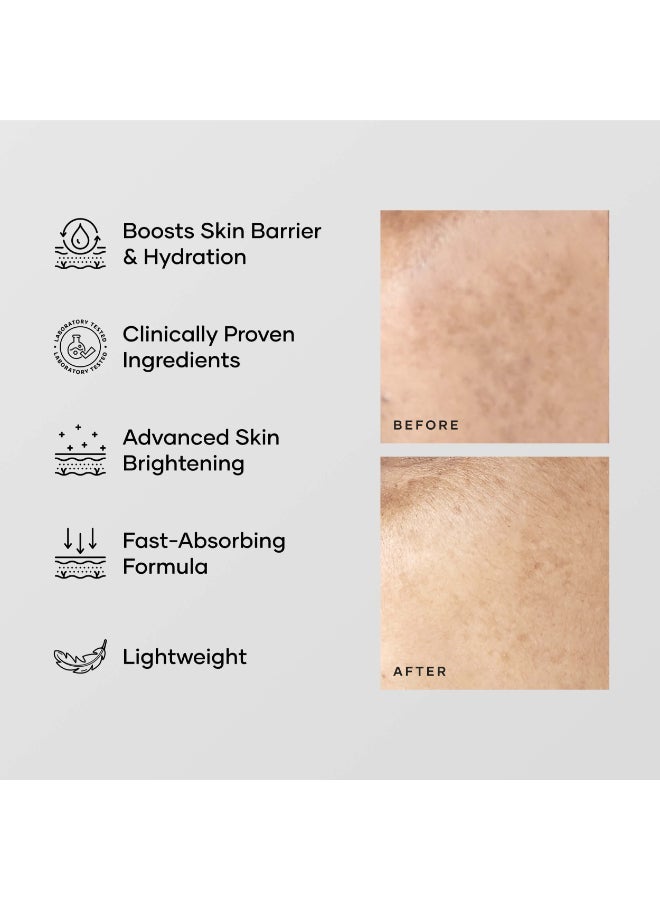 Cureskin Multi-Active Corrector Kojic Acid Face Cream | Kojic Acid, Alpha Arbutin & Niacinamide | For Uneven Skin Tone, Dullness & Visible Spots - Image 3