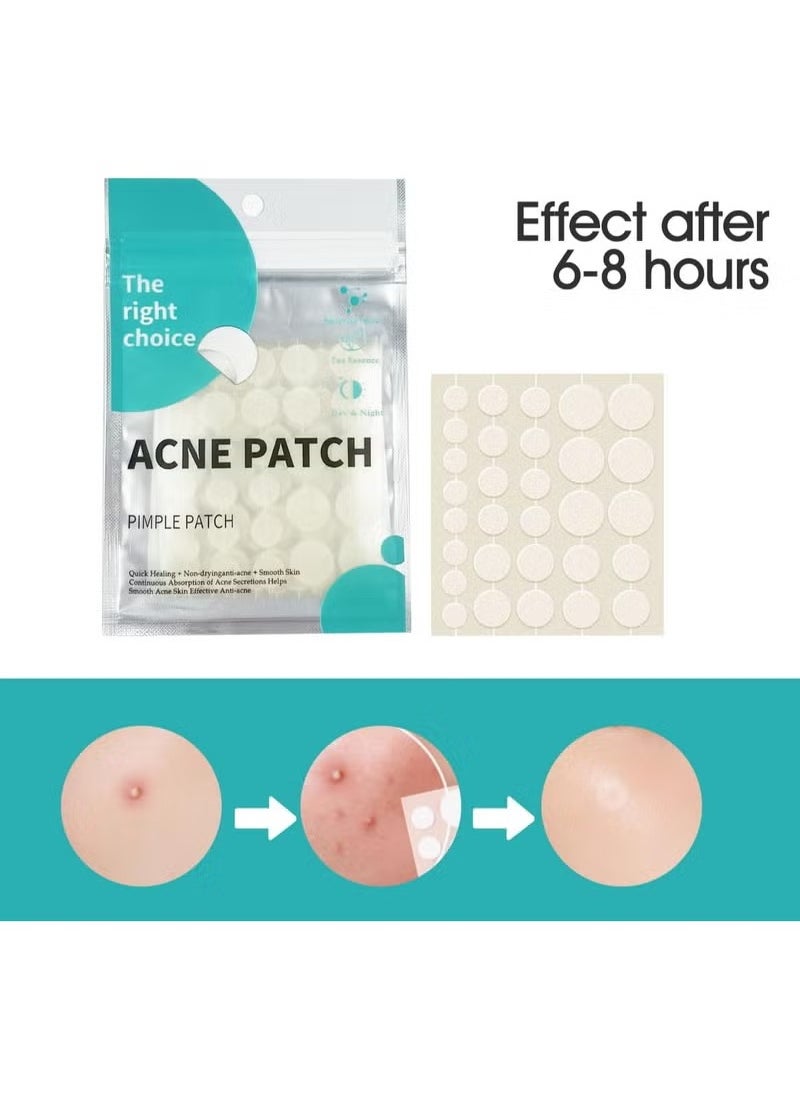 Acne Pimple Patches,Hydrocolloid Acne Patch for Covering Face, Blemishes, Zits Absorbing Patch,Cosmetics Patch for Pimple Dots, Acne Treatment, Invisible Acne Spot Patches(150 Count)