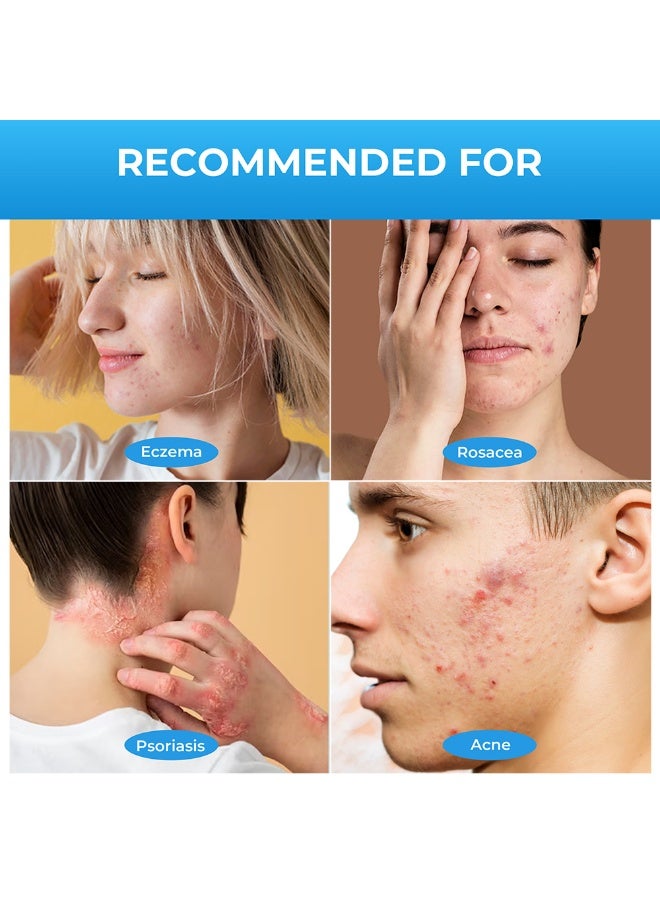 Sumifun Extra Strength Calamine Psoriasis Ointment Cream - Image 4