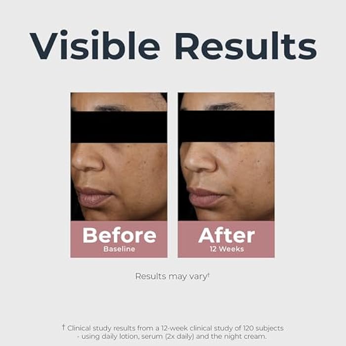 Eucerin Radiant Tone Daily Face Lotion with SPF 30, Dark Spot Corrector with Thiamidol, Helps Visibly Reduce the Look of Dark Spots, All Skin Types, Holiday Gifts for Self Care, 1.7 Fl Oz Bottle - Image 4