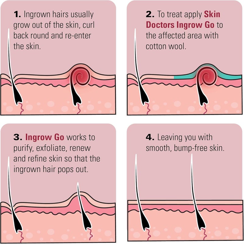 Skin Doctors لوسيون سكين دكتورز إنغرو غو لعلاج الشعر الناشئ يقلل من حروق الحلاقة والنتوءات أستخدمه على الساقين ومنطقة البيكيني وتحت الإبط والوجه 120 مل - Image 4