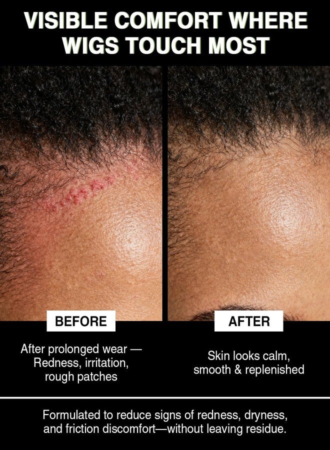 EJW Wig Wearers Soothing Serum – Comfort Scalp & Hairline, Hydrates Skin After Glue, Tape or Cap Wear, Soothes Pressure Marks Under Lace Fronts, Lightweight Refreshing with Hyaluronic Acid & Ceramides - Image 3