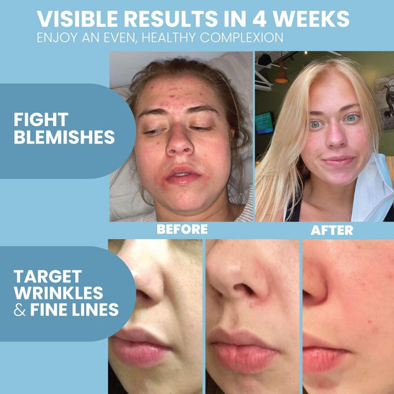 Eva Naturals Retinol Serum for Face â€“ Anti Aging Night Serum with Hyaluronic Acid, Vitamin E, Witch Hazel, Aloe â€“ Wrinkle Moisturizer, Dark Spot Corrector, Acne Scar Treatment, Skin Brightening â€“ 2oz - Image 3